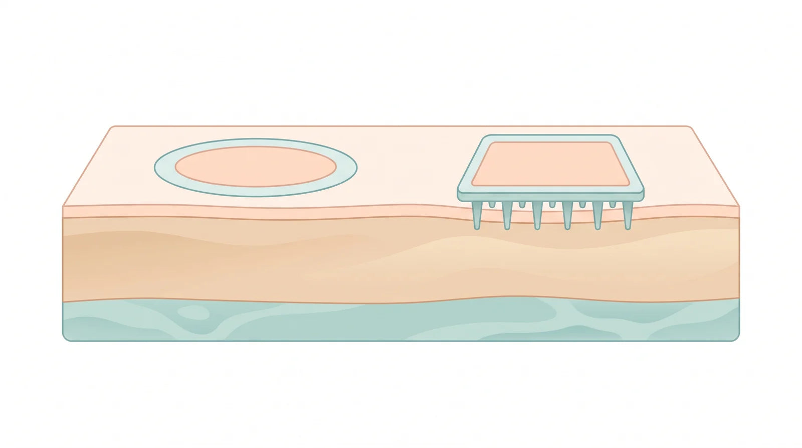 Illustration of skin layers with a flat round sticker resting on the surface and a microneedle patch whose tiny needles reach into the outer layer