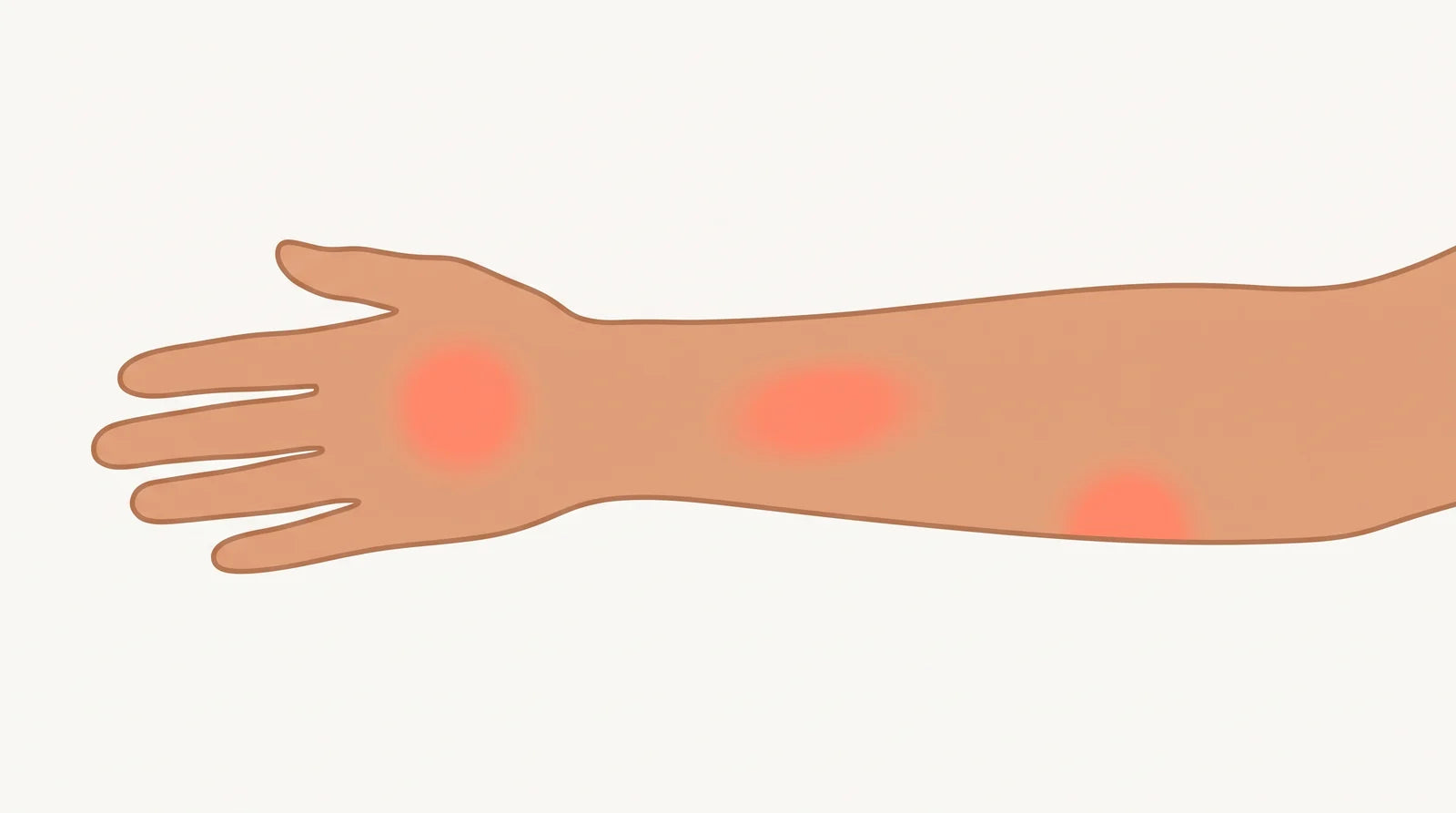 Illustration of a woman's hand and forearm with three soft warm patches, on the back of the hand, the middle of the forearm, and near the elbow, representing skin tingling or touch sensitivity