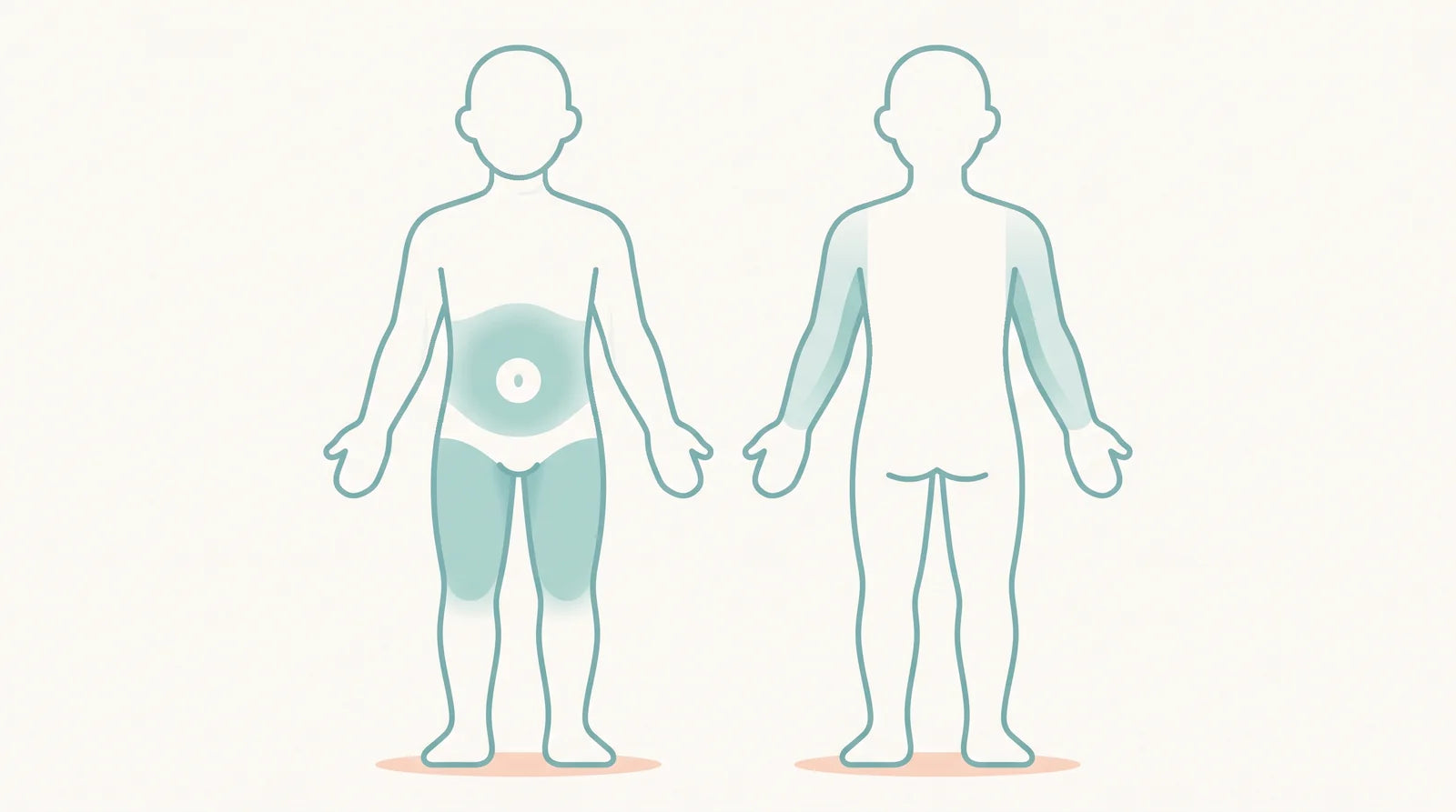 Body outline showing the three Zepbound injection areas: stomach, thighs, and back of the upper arms for a helper